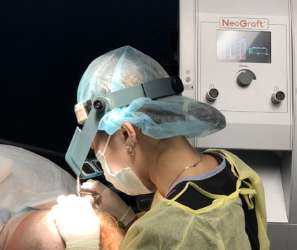 neograft-hair-transplants-raleigh-north-carolina NeoGraft FUE Hair Restoration Transplants Raleigh NC